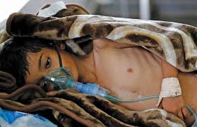 اليمن  ارتفاع الوفيات إلى 798 شخصا بمرض الكوليرا