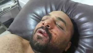 وفاة المواطن المصرى المعتدى عليه بالأردن