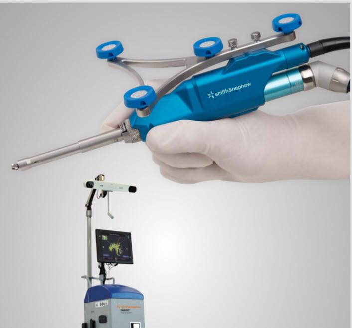 شركة سميث ونيفيو تطرح ”روبوت” لإستبدال مفصل الركبه بالسعودية