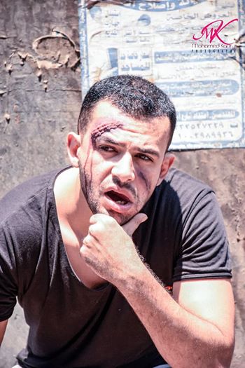 محمود إمام يرتدى عباءة ” الجوكر” فى جلسة تصوير جديدة