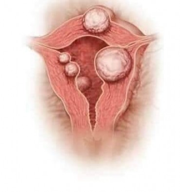 غدا ...المؤتمر الدولي الثاني عشر للاورام