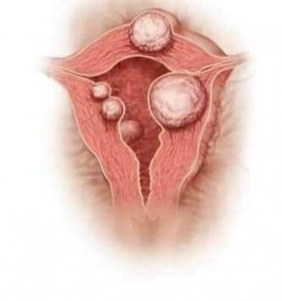 غدا ...المؤتمر الدولي الثاني عشر للاورام