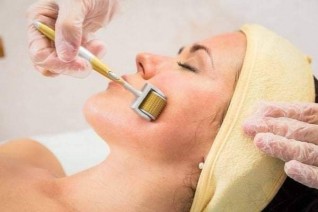 تعرف على أقوى تقنية فى التجميل بدون حقن